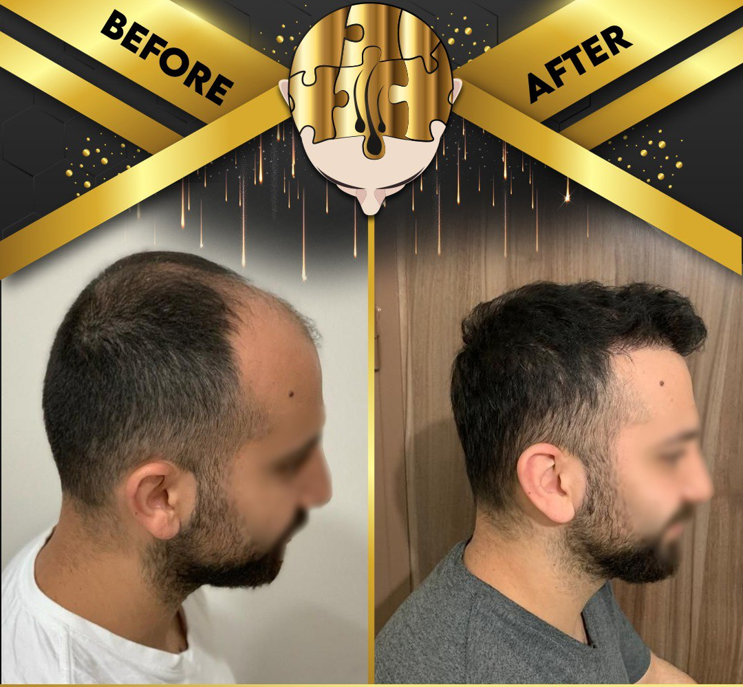 30